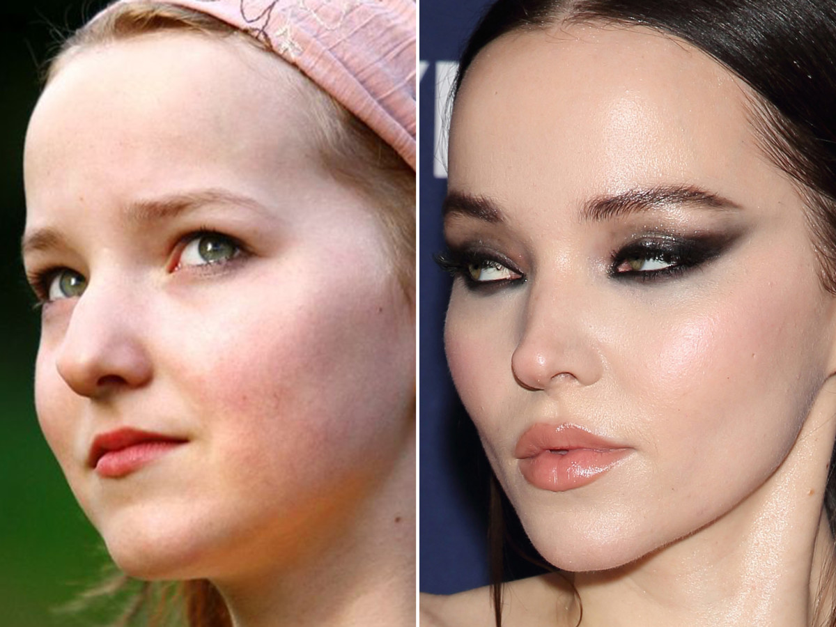 Dove Cameron before and after